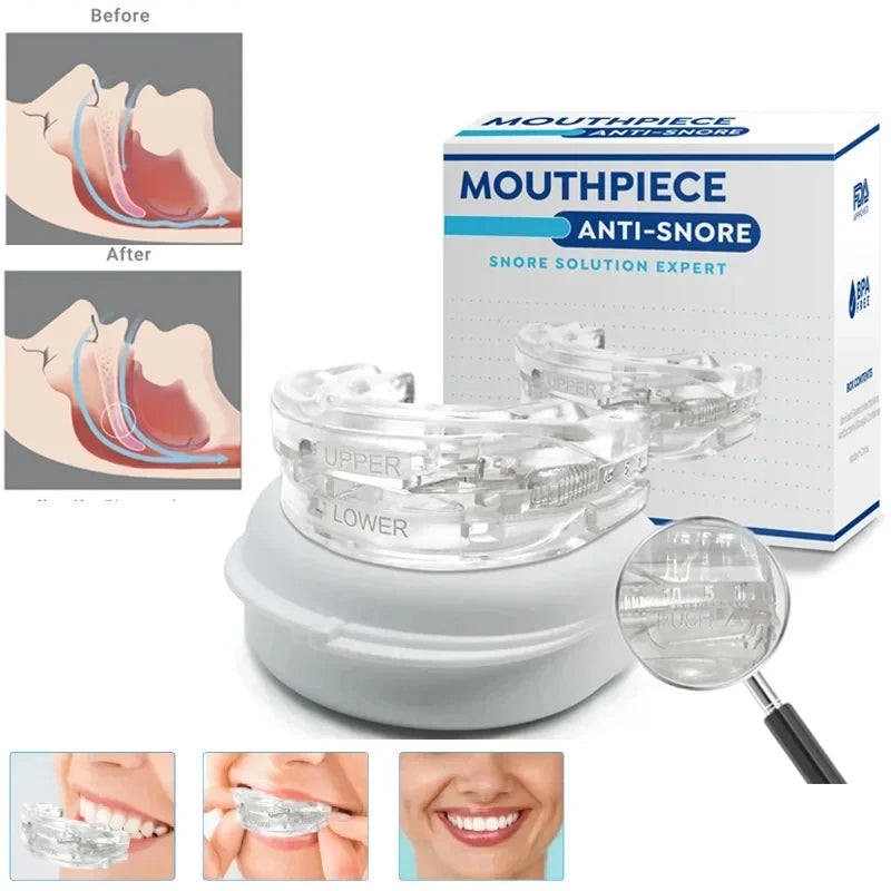 Anti-snore mouthpiece with packaging and before-after illustrations on a white background