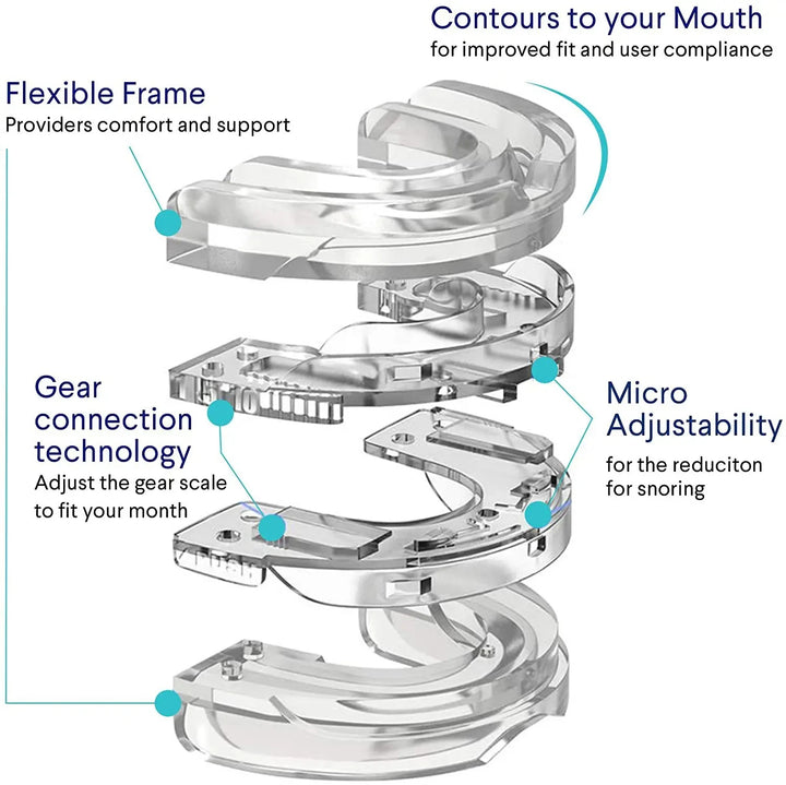 Diagram of a clear mouthpiece with labeled features on a white background